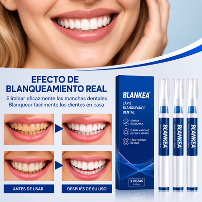 Lápiz Blanqueador